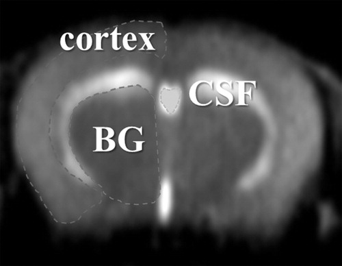 Figure 1. Regions of interests (ROIs) were selected semi-automatically using image processing software. BG: basal ganglia, CSF: cerebrospinal fluid.