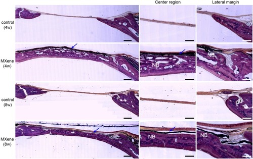 Figure 6 Undecalcified histological sections of calvarial samples 4 and 8 weeks after surgery following Van Gieson’s staining. Left images show the volume of newly formed bone with/without MXene films at low magnification. Scale bars: 500 µm. Right images show the newly formed bone (NB) in the central region and lateral margin of the bone defects under MXene films at high magnification. Blue arrows mark the MXene films. Scale bars: 200 µm.Abbreviation: NB, new bone.