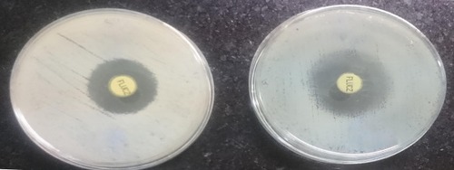 Figure 2 Susceptibility pattern of C. albicans isolates to Fluconazole (25 µg) showing different sizes of inhibition zone: (A) 14 mm (R), and (B) 22mm (S).