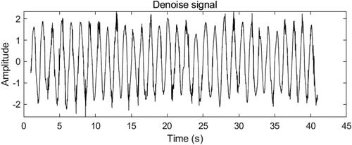 Figure 5. EMD-CWT noise reduction diagram.