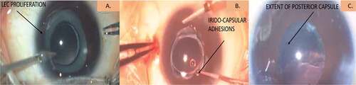 Figure 1. Schematic representation of pre-operative assessment (A-C).