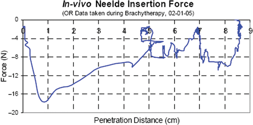 Figure 5. In-vivo needle insertion force measured during actual (conventional) prostate brachytherapy procedure in the operating room.