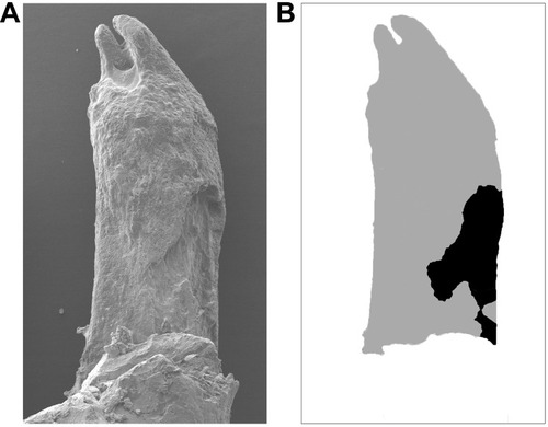 Figure 2 Analysis of root resorption area.