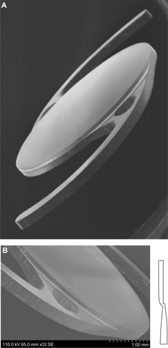 Figure 1 (A) Design of the MX60 intraocular lens (Bausch & Lomb, Rochester, NY, USA). (B) Posterior surface facing toward the right side of the page. The haptics are offset anteriorly with respect to the optic body, which enables consistent posterior movement of lens optic under haptic compression. Images courtesy of David Spalton, FRCS, FRCP, FRCOphth.