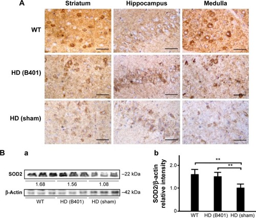 Figure 6 Expressions of anti-oxidative stress-related SOD2 in the brain tissue of the R6/2 (HD) mice were enhanced under oral B401 treatment.