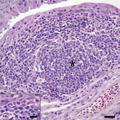 Figure 2.  Conjunctiva from a cliff swallow with conjunctivitis. Lymphocytes and plasma cells (inset: bar = 10 µm), along with a focus of follicular lymphoid hyperplasia (*), infiltrate and expand the lamina propria. Bar = 20 µm. Haematoxylin and eosin.