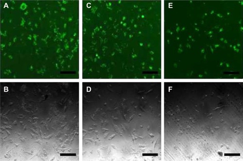 Figure 6 Fluorescence micrographs and cell micrographs of EA.hy926 cells.Notes: EA.hy926 cells were transfected with (A, B) CASF/pDNA (at weight ratio of 32/1), (C, D) CASF/pDNA (at weight ratio of 48/1), and (E, F) PEI/pDNA (at weight ratio of 3/2). Scale bar is 100 μm.Abbreviations: CASF, cationized Antheraea pernyi silk fibroin; pDNA, plasmid DNA; PEI, polyethyleneimine.
