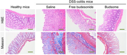 Figure 7. Representative images of colon sections stained with H&E and Masson’s trichrome. Scale bars: 100 µm.