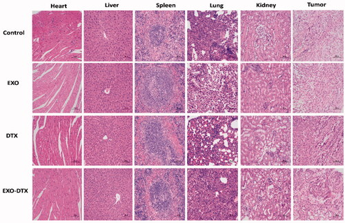 Figure 9. H&E staining images of tumor-bearing mice heart, liver spleen, lung, kidneys, and tumor (×200).