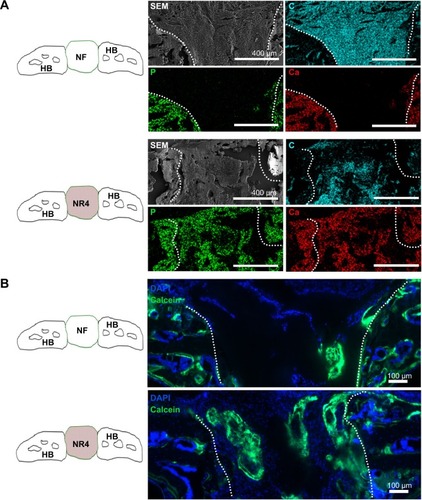 Figure 6 BMP-7 nanoreservoirs’ effect in vivo on bone mineralization.Notes: (A) SEM micrographs, after 30 days of implantation in mouse skull, showing the morphology and composition of the scaffolds; corresponding elemental mapping of P (green), Ca (red), and C (blue) is depicted. Overall SEM visualization of the grafts is in gray. (B) In vivo bone induction onto NF scaffold or onto NR4 PCL scaffold 30 days after calvaria implantations in nude mice. Cell nucleus is in blue, stained with DAPI; bone information is shown in green, stained with calcein. For all images, scale bars =100 μm.Abbreviations: C, carbon; Ca, calcium; HB, host bone; NF, not functionalized; NR4, functionalized with (chitosan/BMP-7)4 nanocontainers; P, phosphorus; PCL, poly(ε-caprolactone); SEM, scanning electron microscopy.