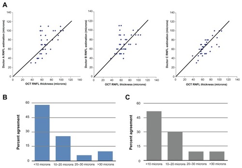 Figure 1 (A) Correlation graphs of retinal nerve fiber layer (RNFL) thickness estimations for physicians A, B, and C compared with optical coherence tomography (OCT). An exact reproducibility between physician and OCT results in a point plotted on the 45° graph line. A physician overestimation compared with OCT plots above the line, and an underestimation plots under the line. The further away a point is from the 45° line, the greater the difference between the RNFL estimation of the physician from the OCT. Below, percent of eyes (x-axis) that had RNFL thickness estimation agreement for each range in the y-axis between (B) two physicians and (C) physician and OCT.