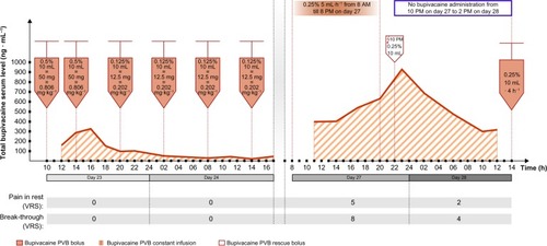 Figure 3 Total bupivacaine serum levels following its administration in boluses and in constant paravertebral infusion (ng · mL−1) in the presented case.