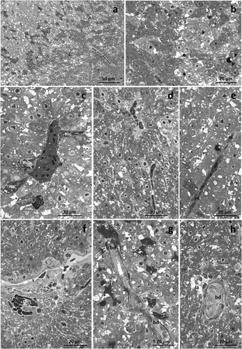 Figure 3. Light micrographs of Danio rerio liver after 192 hours of exposure to TBZ. (a) The dyschromia of the liver parenchyma further increases, and glycogen granules are less frequent. (b) Note the intensification in the number of slightly-stained (black asterisk) and deeply-stained (white asterisk) hepatocytes. (c) Blood vessels are congested, and pigmented melano-macrophage complexes (mc) are frequently detected. (d,e) Occluded sinusoids are filled with numerous macrophages. (f) Note the dilation of Disse’s space (ds) and the numerous immigrated macrophages dispersed in the parenchyma. (g,h) Detail of bile duct degeneration and lysed areas (la) dispersed in the parenchyma. s = sinusoid, v = vein, m = macrophage, bd = bile duct, arrow-head = lipid droplet.
