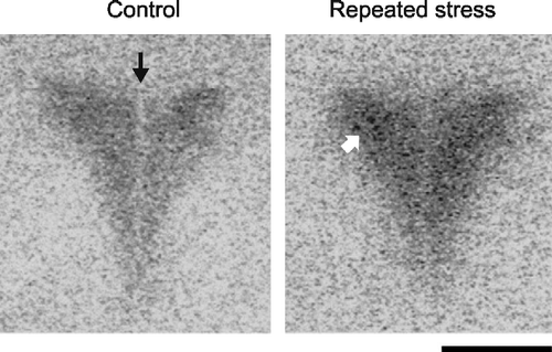Figure 1 Increased Ang II receptor expression in the PVN after repeated restraint stress. The figure represents a typical autoradiography image of Ang II receptor binding in a coronal section of the hypothalamus through the paraventricular nuclei, as determined after incubation in the presence of [125I]-Sarcosine1-Ang II, in control rats and in rats submitted to seven repeated sessions of 2 h restraint. Black arrow indicates the third ventricle. Binding is concentrated in the parvocellular region of the PVN (white arrow). Note the intense signal generated after repeated restraint stress. Bar is 0.5 mm (modified from Castrén and Saavedra Citation1988).