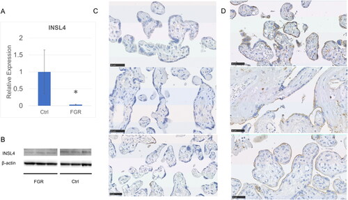 Figure 2. Downregulation of INSL4 expression in full-term FGR placentas. (a) mRNA and (b–d) protein expression levels of SIRT1 were analyzed using (a) RT-qPCR, (b) western blotting, and (c) immunohistochemical analysis of full-term FGR placental tissues and (D) full-term normal delivery or C-section placental tissues. Data are presented as the mean ± SEM. Asterisks (*) indicate statistical significance as compared with the control (p < .05). Ctrl: control placenta; FGR: fetal growth restriction; INSL4: insulin-like 4.