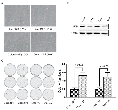 Figure 1. Isolation and identification of cancer-associated fibroblasts from clinical colon cancer and liver cancer. (A) The morphology of CAF and NAF isolated from colon cancer or liver cancer. (B) Identification of CAF by FAP expression. C. Identification of CAF by its tumor-promoting effect. The cologenic assay was performed. *: p < 0.05.