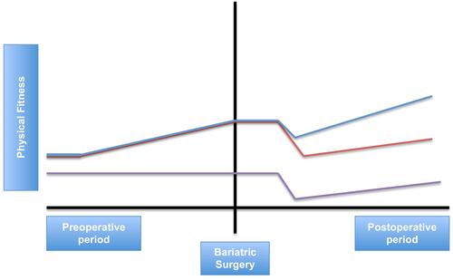 Figure 1 Conceptual framework of perioperative exercise interventions in bariatric surgery. Purple line: patients who do not receive any perioperative exercise intervention. Orange line: patients who only receive preoperative exercise training. Blue line: patients who receive preoperative and postoperative exercise training.
