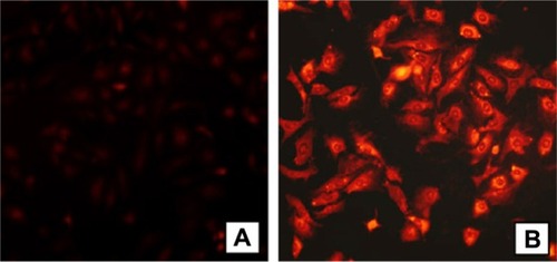 Figure 3 Fluorescence microscopy of A549 cells containing doxorubicin polymeric micelles, (A) A549 cells incubated with free doxorubicin and (B) A549 cells incubated with polymeric micelles conjugated with doxorubicin.Note: Doxorubicin concentration = 10 μg/mL. Copyright © 2011. Elsevier. Reproduced with permission from Zhao Y, Sun C, Lu C, et al. Characterization and anti-tumor activity of chemical conjugation of doxorubicin in polymeric micelles (DOX-P) in vitro. Cancer Lett. 2011;311:187–194.Citation54