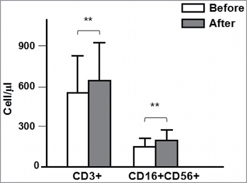Figure 1. Changes in the lymphocyte subsets before and after NK cell treatment (**P < 0.01).