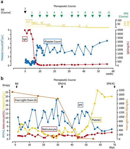 Figure 3 Therapeutic course. (a) Created with September 9th, the start date of the first course of Bd therapy, as day 1. (b) Before DPd treatment, reticulocyte generally remained within the normal range of 0.7–2.3% (normal range: 0.8–2.0%), with no decline observed, and the IPF has consistently remained high. After DPd treatment, a decrease in IPF and an increase in platelet count were observed.