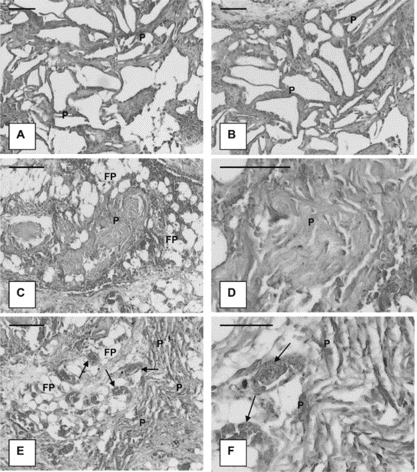 Figure 4 Histological appearance of sponge implants retrieved: (A) after 10 weeks [AC5.0]; (B) after 10 weeks [AC2.5]; (C) after 30 weeks [AC2.5]; (D) higher magnification of C; (E) adjacent tissue at 60 weeks post-implantation [AC2.5]; (F) higher magnification of E; P: polymer, arrows: capillaries; FP: fat pad; H&E-stainings; scale bars = 100 µm.