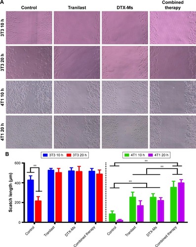 Figure 3 Cell scratch wound assay after different treatments.Note: (A) Photographs and (B) statistical analysis of 4T1 or 3T3 after being treated with PBS, tranilast (200 µM), DTX-Ms (10 µM), and combination therapy (tranilast 200 µM and DTX-Ms 10 µM) for 10 or 20 hours. n=4. **P<0.01.Abbreviation: DTX-Ms, docetaxel micelles.