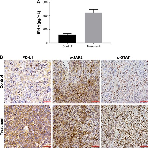 Figure 4 In vivo anti-PD1 treatment induced PD-L1 expression through IFN-γ associated with JAK-STAT pathway in EL4 tumors.Notes: (A) IFN-γ concentration is higher in treatment group than the control (120 vs 444.1 pg/mL, P<0.05). (B) PD-L1, p-JAK2, p-STAT1 protein expression in IHC was evaluated. Scale bar 50 μm; magnification ×400.