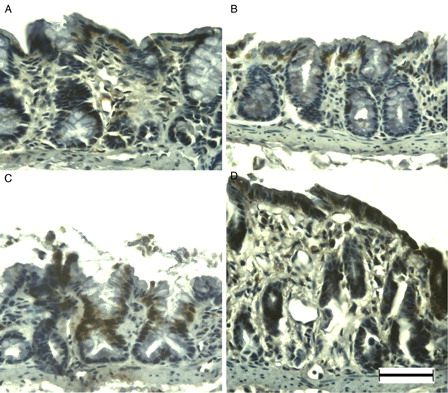 Figure 4. MSH6 immunohistochemistry of DSS-induced colitis in young rats. MSH6 was immunopositive at the surface epithelium in the colon of young rats (A), and at DSS-3d (B). Compared to DSS-3d, MSH6 was immunopositive in the majority of enterocytes at DSS-5d (C), and blurred in the entire colon at DSS-7d (D). Scale bar = 50 µm.