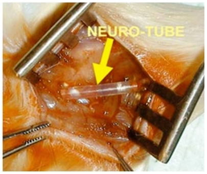 Figure 3 Silicone tube for nerve regeneration.