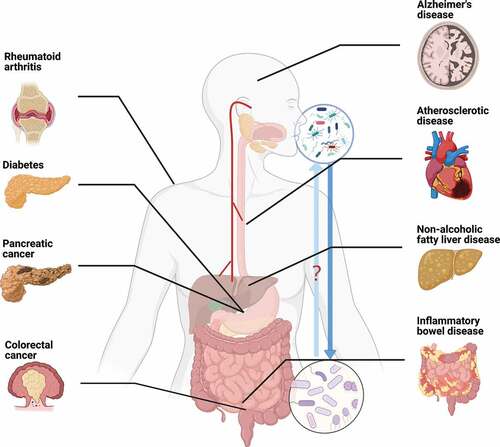 Figure 2. The interplay between oral microbiota and gut microbiota, and the contribution of this interplay on systemic diseases, including gastrointestinal system diseases like inflammatory bowel disease, colorectal cancer, pancreatic cancer and nonalcoholic fatty liver disease, nervous system diseases like Alzheimer’s disease, endocrine system diseases like diabetes, immune system diseases like rheumatoid arthritis and cardiovascular system diseases like atherosclerotic disease. Created with BioRender.Com.