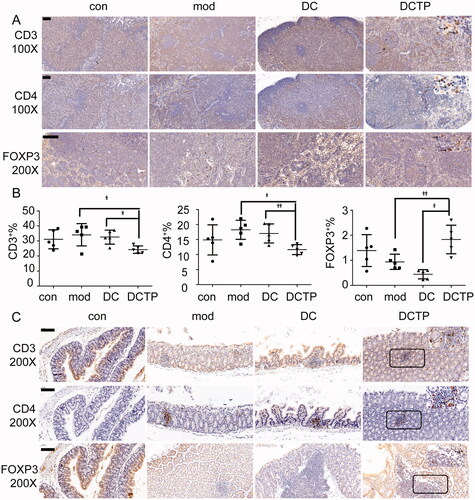 Figure 5. Analysis of lymphocytes in the mesenteric lymph nodes (mLN) and colon. (A) Immunohistochemical staining for CD3+ and CD4+ T cells and FoxP3+ Tregs in mLN from normal (Con) and experimental colitis mice treated with saline (Mod), DCs, or DCTP. Significant decrease in CD3+ and CD4+ T cells and increase in FoxP3+ Tregs were found in DCTP-treated mice compared with mice in the DC and mod groups. (B) FCM analysis of the CD3+, CD4+, and FOXP3+ T cell percentages in mLN showed an increase in Tregs and decrease in CD3+ and CD4+ T cells in the DCTP group. Experiments were repeated three times in quintuplicate each time (n = 15). (C) Immunohistochemical staining for CD3+ and CD4+ T cells and FoxP3+ Tregs in the colon of normal (Con) and experimental colitis mice treated with saline (Mod), DCs, or DCTP. Significant decreases in CD3+ and CD4+ T cells and an increase in FoxP3+ Treg infiltration were found in the colon of mice in the DCTP group compared with that of mice in the DC and Mod groups. Equivalent larger versions were shown in upper right corner for better observation (the scale bar represents 100 µm; two-tailed t-test, *p<.05, **p<.01).