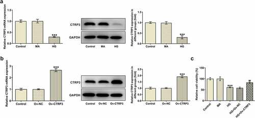 Figure 1. Overexpression of CTRP3 enhances the viability of HG-induced HRPs. (a) CTRP3 expression in control group, MA group and HG group was examined through RT-qPCR and Western blot. ***P < 0.001 vs. MA. (b) The transfection efficiency of Ov-CTRP3 plasmid was tested by RT-qPCR and Western blot. ***P < 0.001 vs. Ov-NC. (c) Cell proliferation was evaluated by CCK-8 assay. ***P < 0.001 vs. MA. ##P < 0.01 vs. HG+Ov-NC. CTRP3, C1q/tumor necrosis factor-related protein-3. HG, high glucose. MA, mannitol.