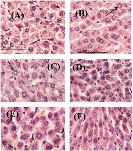 Figure 7. Sections stained with hematoxylin and eosin (H&E; 100×) histological examination of rats hepatocytes of different groups compared to control group (A); (B) LPS (10 mg/kg.B.W.); (C) MeOH extract (200 mg/kg b.w.); (D) MeOH extract (400 mg/kg.b.w.); (E) n-BuOH extract (100 mg/kg b.w.); (F) n-BuOH extract (200 mg/kg b.w.).