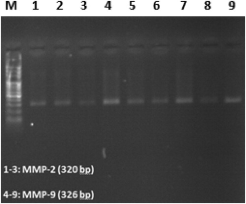 Figure 1. Electrophoresis of BSP products on 1% agarose gel. Molecular weight marker (M) is 100 bp ladder. MMP-2, Matrix metalloproteinase-2; MMP-9, Matrix metalloproteinase-9.