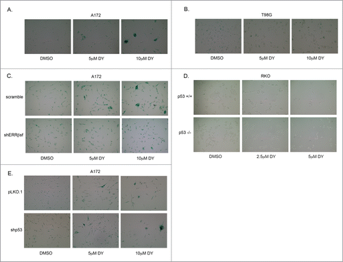 Figure 8. ERRβsf induces cellular senescence independent of p53 status. (A) SA-β-galactosidase assay in A172 parental cells after 24 h DY treatment. (B) SA-β-galactosidase assay in T98G parental cells after 24 h DY treatment. (C) SA-β-galactosidase assay comparing A172-scramble and –shERRβsf cells after 24 h DY treatment. (D) SA-β-galactosidase assay in RKO isogenic mutant cells after 24 h DY treatment. (E) SA-β-galactosidase assay comparing A172-pLKO.1 and -shp53 cells after 24 h DY treatment.