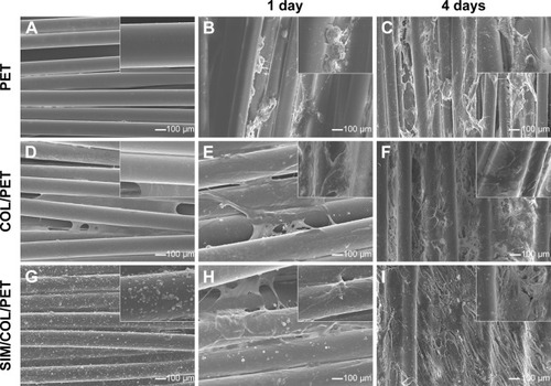 Figure 3 Scanning electron microscopic images of morphologic changes and cell adhesion in different fibers at 1 day and 4 days (100× magnification).Notes: Micromorphology: original PET fibers (A), COL/PET (D), SIM/COL/PET (G); BMSCs adhesion: PET (B, C), COL/PET (E, F), and SIM/COL/PET (H, I). Insets show magnified sections of A-I (10× magnification).Abbreviations: PET, polyethylene terephthalate; COL/PET, collagen coating on polyethylene terephthalate scaffolds; SIM/COL/PET, collagen and simvastatin microspheres coating on polyethylene terephthalate scaffolds; BMSCs, bone marrow stromal cells.