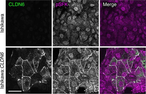 Figure 4. Aberrant SFK activation in human endometrial cancer cells by CLDN6. Scale bar, 20 μm