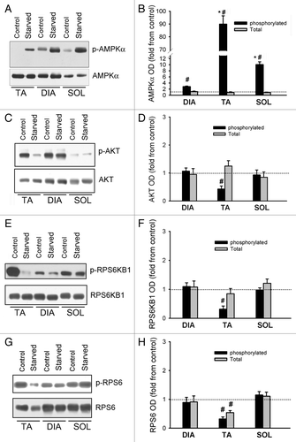 Figure 8. Activation of AMPK, AKT, and MTORC1 pathways. (A) Representative immunoblots of total and phosphorylated (Thr172) AMPK in DIA, TA, and SOL muscles of control and acutely starved mice. (B) Protein optical densities of total and phosphorylated AMPK in DIA, TA, and SOL muscles of control and acutely starved mice. Values (means ± SEM) are expressed as fold change relative to control group. *P < 0.05, as compared with DIA. #P < 0.05, as compared with control. n = 6 per group. (C) Representative immunoblots of total and phosphorylated (Ser473) AKT in DIA, TA, and SOL muscles of control and acutely starved mice. (D) Protein optical densities of total and phosphorylated (Ser473) AKT in DIA, TA, and SOL muscles of control and acutely starved mice. Values (means ± SEM) are expressed as fold change relative to control group. #P < 0.05, as compared with control. n = 6 per group. (E) Representative immunoblots of total and phosphorylated (Thr389) ribosomal protein S6 kinase B1 (RPS6KB1) in DIA, TA, and SOL muscles of control and acutely starved mice. (F) Protein optical densities of total and phosphorylated (Thr389) RPS6KB1 in DIA, TA, and SOL muscles of control and acutely starved mice. Values (means ± SEM) are expressed as fold change relative to control groups. #P < 0.05, as compared with control. n = 6 per group. (G) Representative immunoblots of total and phosphorylated (Ser235/236) ribosomal protein S6 (RPS6) in DIA, TA, and SOL muscles of control and acutely starved mice. (H) Protein optical densities of total and phosphorylated (Ser235/236) RPS6 in DIA, TA, and SOL muscles of control and acutely starved mice. Values (means ± SEM) are expressed as fold change relative to control groups. #P < 0.05, as compared with control. n = 6 per group.