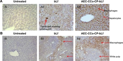 Figure 6 Immunoreactivity in different organs.Notes: (A) Immunoreactivity with liver cells: (Ai) Liver cells of mice fed with normal diet showing negative IHC. (Aii and Aiii) Lf-treated mice showing positive IHC in liver Kupffer cells and negative in hepatocytes when observed at ×20 and ×40. (B) Immunoreactivity with spleen cells: (Bi) Spleen cells of mice which were fed with normal diet showing negative IHC. (Bii) Lf-treated mice showing positive IHC (brown color using DAB) in spleen macrophages cells ×20. (Biii) Positive IHC of spleen cells ×40.Abbreviations: AEC-CCo-CP-bLf, alginate chitosan calcium phosphate bovine lactoferrin; bLf, bovine lactoferrin; DAB, diaminobenzidine; IHC, immunohistochemistry; Lf, Lactoferrin.