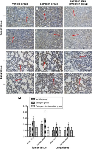 Figure 8 Protein immunohistochemical results of PI3K in mice tumor tissue and lung tissue; 400× magnification.