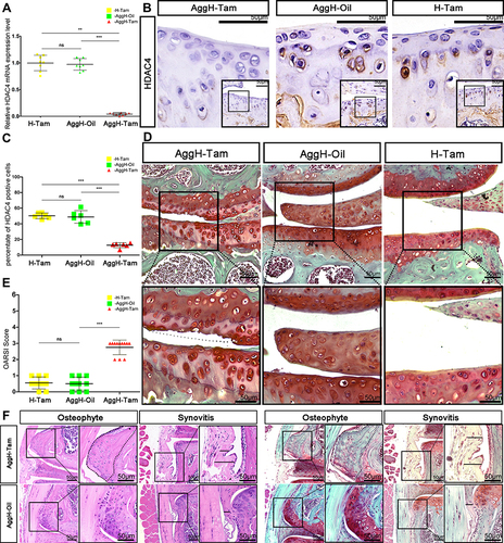 Figure 3 Eight-month-old mice experienced early osteoarthritis (OA) after histone deacetylase 4 (HDAC4) knock out. (A) The relative mRNA expression of HDAC4 was significantly reduced after tamoxifen injection in 2-month-old mice. (B) Positive HDAC4 staining was hardly seen in the cartilage of 8-month-old AggH-Tam mice. Scale bars:50μm. (C) Quantitative analysis of HDAC4 expression showed that HDAC4 expression was consistently reduced up to the age of 8-months. (D) Safranin O staining of 8-month-old mice in all three groups showing OA changes in the AggH-Tam group. The dotted line shows where the surface of the cartilage should be. Scale bars:50μm. (E) Osteoarthritis Research Society International (OARSI) scores for all three groups showing significant OA changes in AggH-Tam group mice at the early stage of OA progression. (F) Osteophytes and thickened synovium were observed in 8-month-old AggH-Tam group mice. The dotted line shows the outgrowing osteophyte of the knee joint. The black line in the image indicates the thickened synovium. Scale bars:50μm.