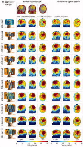 Figure 5. Top row: sagittal, coronal and axial section through the large tumor model. Left: description and front view of each design simulated together with the large tumor model; maximum intensity projection of the SAR10g distribution after hyperthermia treatment planning for the power optimization (center) and the uniformity optimization (right).