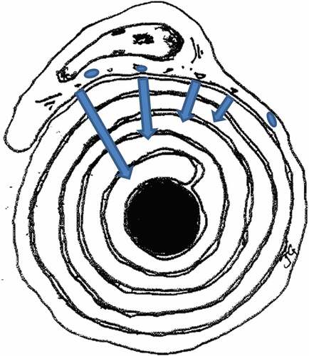 Figure 17. Diagrammatic representation of a suggested, unexpected peculiar centripetal diffusion (blue arrows) of myelin compound(s) dispatched by Schwann cells. Axon in black.