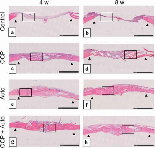 Figure 3. Lower magnified images of rat calvarial defect regions in the sections with haematoxylin-eosin staining at 4 weeks (a, c, e, g) and 8 weeks (b, d, f, h) of implantation of no materials (Control) (a, b), OCP (c, d), autogenous bone (e, f), and mixture of OCP and bone (g, h). Bars in the images represent 2.5 mm. Arrow heads indicate the edges of bone defects