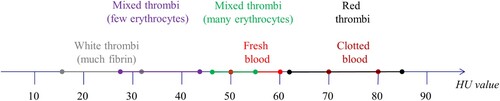 Figure 3. Hounsfield units of blood and thrombi according to (Mecke Citation2008; Vock and Woermann Citation2021).