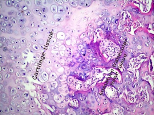Figure 3 Histopathological sample of bone tissue. The sample shows mostly cartilage and a little newly formed, immature bone tissue.