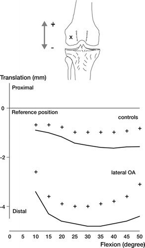 Figure 15. Proximal-distal translation of the lateral condylar flexion facet center. The lateral condyle had a more distal position and especially up to 20° probably because of loss of cartilage and bone. Numbers of observations are placed according to Figure 13. Mean and standard error of the mean (SE) are shown.