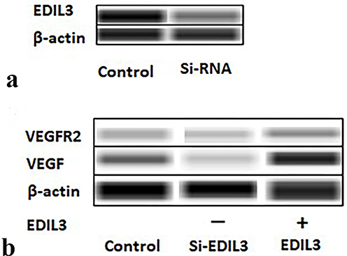 Figure 2 Images of Western blotting assay. (a) After EDIL3 knockdown in ECs, the expression of EDIL3 was detected. The image shows that EDIL3 expression in the si-EDIL3 group was significantly lower than that in the control group. (b) VEGF and VEGFR2 protein levels in the cells of both groups were determined by Western blotting assay. EDIL3 promoted VEGF and VEGFR2 expression in ECs.