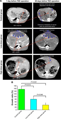 Figure 4 Effect of VEGF siRNA combined with lipiodol (TAE operation) on the growth ratios (GRs) of liver tumors induced by inoculation of VX2 tumor into the liver of rabbits by contrast-enhanced CT image.