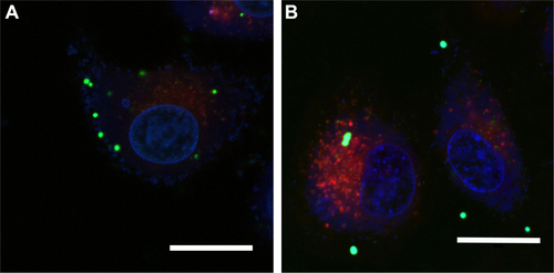 Figure S4 The confocal laser scanning microscope images of the intracellular distribution of FITC-labeled AP-PAMAM (A) and PAMAM (B) after 4 h.Notes: Blue, nuclei (DAPI); red, lysosome (Lyso-Tracker Red); green, carrier (FITC labeled). The scale bar is 20 μm.Abbreviations: AP-PAMAM, 2-amino-6-chloropurine-modified PAMAM; DAPI, 4,6-diamidino-2-phenylindole; PAMAM, polyamidoamine.